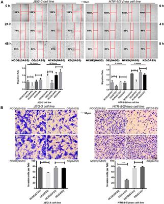 Corrigendum: Long Non-Coding RNA Gas5 is Associated with Preeclampsia and Regulates Biological Behaviors of Trophoblast via MicroRNA-21